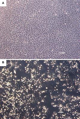 Genomic Characterization of Picornaviruses Isolated From Ribbon (Histriophoca fasciata) and Harbor (Phoca vitulina) Seals